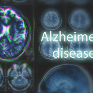 10 Early Signs of Alzheimer&#8217;s Disease