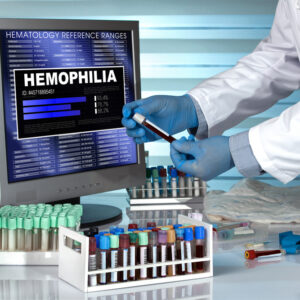 Overview: Hemophilia A and Hemophilia B