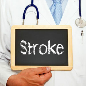 An overview of mini stroke- causes and symptoms explained