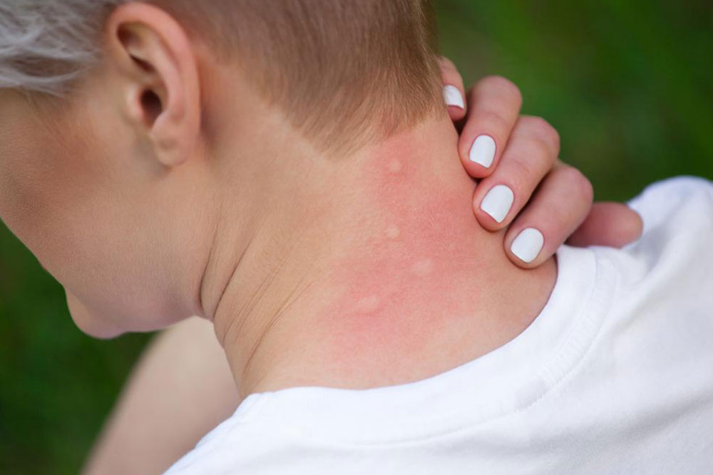 Causes and diagnosis of itchy skin