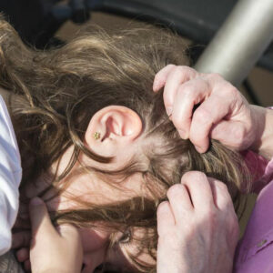 Home remedies for treating head lice