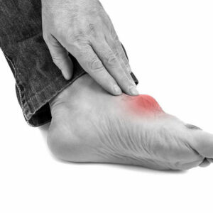 Immediate pain relief measures for gout