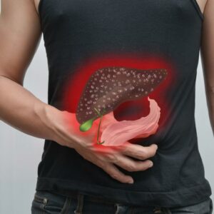 Liver cancer: Causes, symptoms, diagnosis, treatment, and prevention