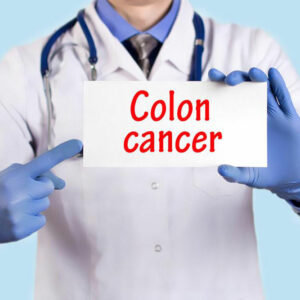 Signs and symptoms of colon cancer