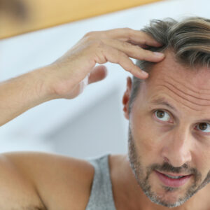 Treatment Options for Hair Loss