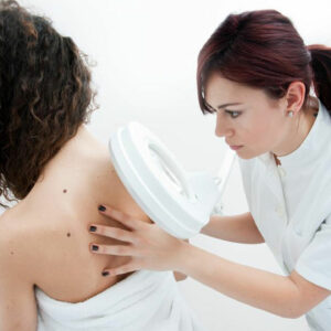 5 ways to reduce the risk of melanoma