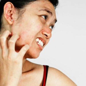 7 easy and useful ways to manage itchy skin