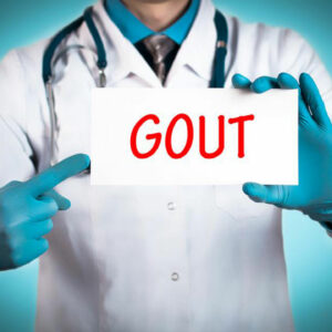 Easy Gout Remedies to Help Manage Pain