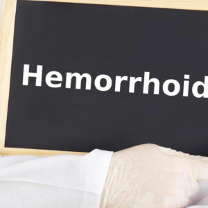 Get Relief with These Effective Hemorrhoids Treatment Options