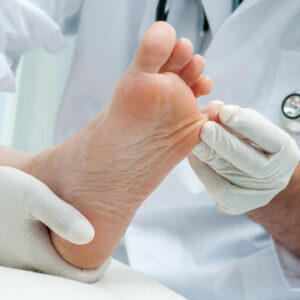 Know How Listerine Can Cure Your Toenail Fungus