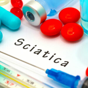 Top Treatment Options for Sciatica