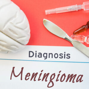 Meningioma &#8211; Symptoms, Causes, Diagnosis, and More